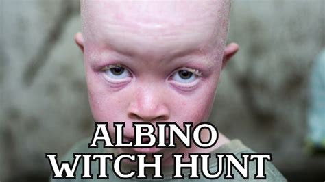 The albjno and thw witch